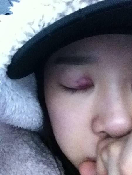 Lee Cheong-ah's bruised self-cam